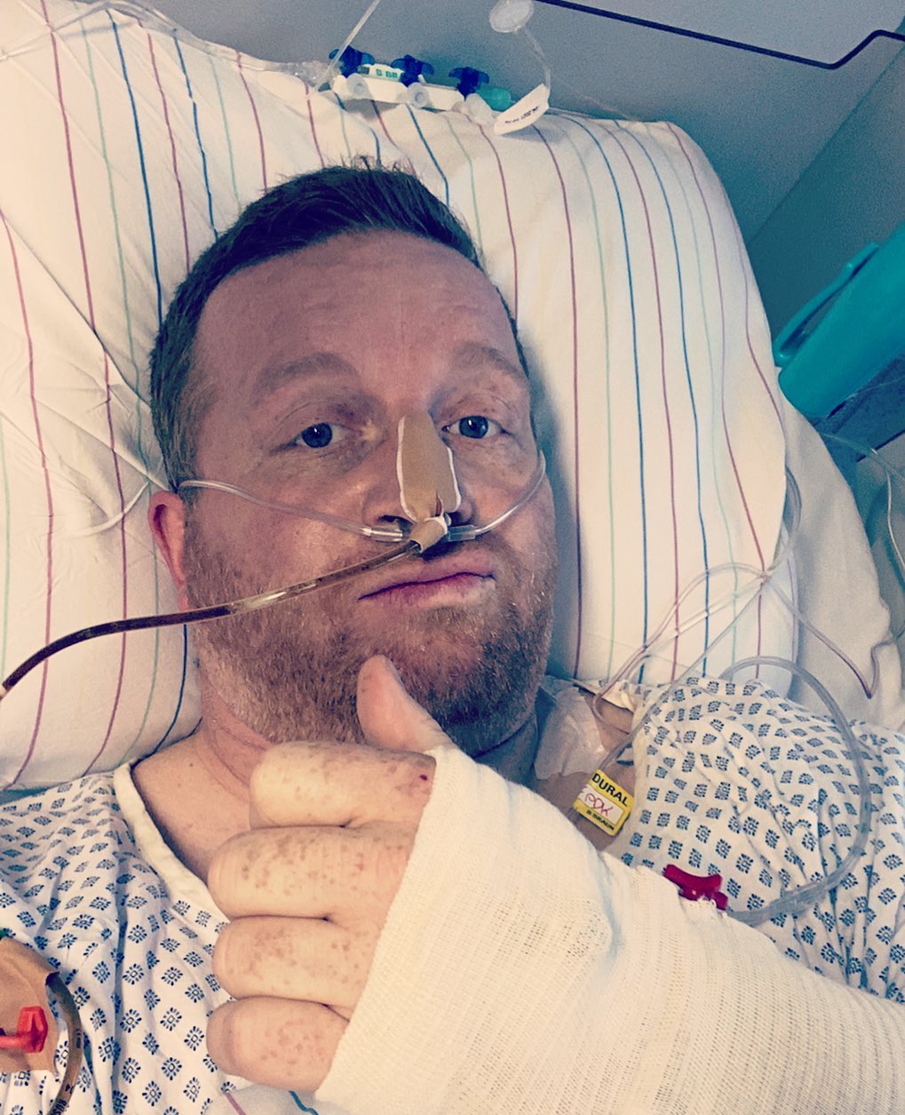 So nun mal zum Anfang. 

Im April diesen Jahres hat sich von jetzt auf nachher alles auf den Kopf gestellt. Was vorher war wird nie wieder so sein und was man sich so vorgenommen hat ist jetzt plötzlich in einem anderen Fokus. 

Mein Dank geht natürlich in erster Linie an meine Frau und an meinen Blinddarm. Dieser ist nämlich geplatzt und diese hat dann den Notarzt gerufen.

Der Tumor hat auf den Blinddarm gedrückt und batzzzz...... 

Nach einer NOT OP Vollnarkose usw ... lag ich dann auf der Intensivstation ... Magensonde hier nen Kabel Rückenmarksdingsi mit Pumpe, spürte meine Beine nimmer .. einfach super ... das wünscht man sich mit 39 ... mehr beim nächsten Beitrag 

Ich bin der Kolbe und hier ist meine Story ....
#cancerfighters #cancerfight #darmkrebstag #krebslogbuch