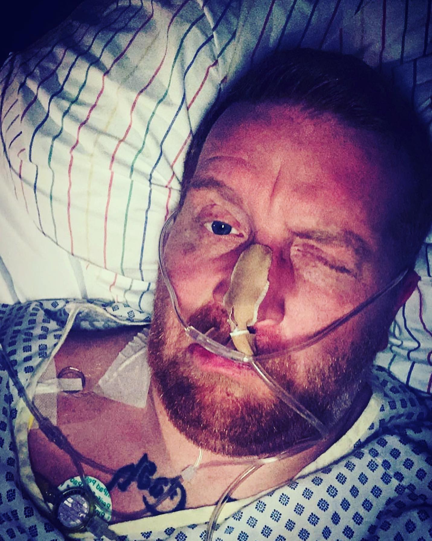 Gedanken von 2021

Ich hatte heute erfahren das mein Krebs unheilbar ist …

……und so begannen die
intensivsten Tage in meine Leben .... Sie
haben Krebs ... bösartigen Krebs ...
Ich war alleine im Zimmer .. durfte nicht
aufstehen und hatte noch nie solche
Angst..
Muss ich sterben ? Wenn ja wann ? Wie
sag ich es meiner Familie ... wie geht's
weiter .
Ich habe 12 std durchgeweint ... so sehr
das nichtmal mehr Tränen kamen ... mir tat
einfach alles weh.

Kopfkino Schmerzen Angst und es roch wieder nach TOT
Wie geht es weiter jetzt ?
Ich nahm das Telefon und wählte die
Nummer meiner Mama…

#krebsisteinarschloch#darmkrebs#krebskämpfer #krebskrank #cancer #cancerfighter #lifestyle #lifeisgood #lifeisbeautiful #lifecoaching #paliativ #darmkrebs#lifeofadventure #love #selfie #healthylifestyle #healthy #gesundheit #gesundleben #krank #krankheit #lebensfreude #lebengenießen #lebensqualität #lebedeinleben #lebensmotto #fickdichkrebs #zitate