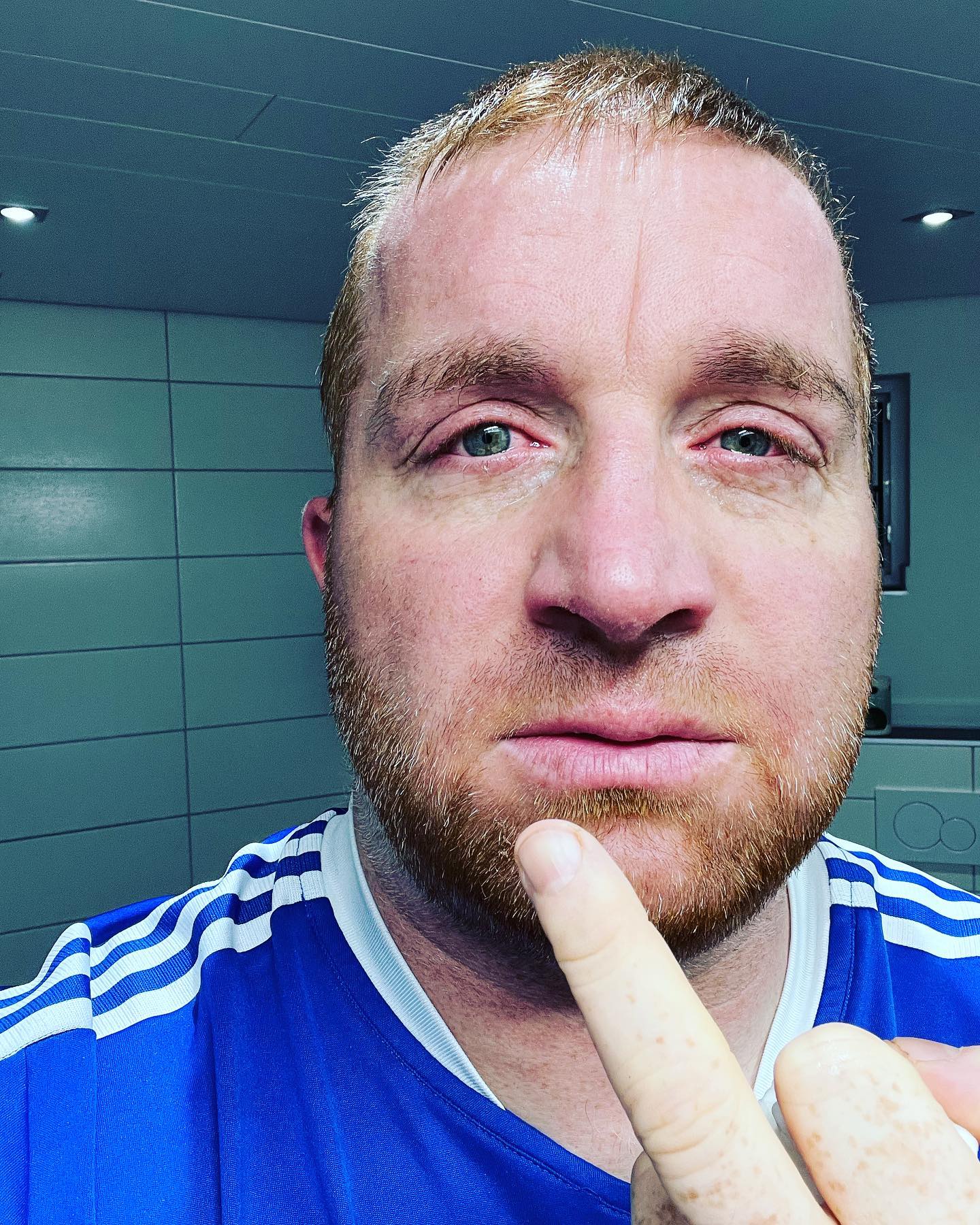 Liebe coolen Männer da draußen. Heute erzähle ich mal was von einer meiner Lebenskrisen. Mal wieder. Wollte nen mega Tag haben. Alles war geplant, Sonne knallt, es war einfach perfekt. Beim aufstehen schon fuck. Mir tut die linke Flanke weh. Wie gestern schon. Schön ignoriert. Bist ja nen Kerl. Auf der Fahrt dann schmerzen gehabt. Schau nicht so dumm mit deinem kack Karren. Ja schmiert es mir auf Brot … überall lachen die Leute. Lacht nur mir eurem perfekten Leben. Ihr kennt keine Probleme. Ja wow prima, hast 3 Kinder. Will ich auch, aber im Gegensatz zu dir verrecke ich bald. Ich merke wie sich die Wut der Gedanken bündelt. Ich will besser heim Schatz, mir geht’s nicht gut. Schweigen, Tränen kullern. Ich schau aus dem Fenster und sehe nur Sachen die ich niemals haben werde. Das machen die mit Absicht. Alles Arschlöcher. Will ins Bett. WhatsApp Instagram alles löschen…. Alles heuchlerische Idioten… ohne Worte. Endlich daheim. Komplett alleine. Ich schrei in mein Kissen. Ich heule wie ein gestörter. Ich hab Angst. Ich vermiss DICH Liebling aber gottverdammt so kann ich dich nicht in den Arm nehmen. Bin völlig ausgebrannt. Dann stille. Lange Zeit. Ein Heulkrampf jagt den nächsten. Zum Glück bin ich alleine. Zeit für mich. Trotzdem will ich jemand bei mir. Ich entschließe zu duschen. Nehme endlich eine Schmerztablette. Merke wie es nachlässt langsam. Der Schatten legt sich langsam. Ich trinke einen Liter Wasser auf Ex. Puh… fast erstickt. Was ist nur los mit DIR ? Was ist da passiert? Was ist aus mir geworden ?  Hör auf deinen Körper, bekomme die Kurve du Trottel. Der ganze Tag am Arsch und 3 Menschen enttäuscht. Wieso ? Für was ? Ich geh in mich. Der Auslöser ist der Schmerz gewesen heute Morgen. Hätte ich um 30minuten Zeit und ne Tablette gebeten wäre ich jetzt der Glücklichste Mensch der zusammen mit der schönsten und tollsten Frau der besten Mama, dem besten Papi einen Ausflug macht. Bekomm es gebacken du Dachlatte. Denk nach und agier nicht wie ein 12 jähriges Baby. Du bist alt genug, kannst reflektieren und denken. Ich hasse dich Krebs und ich trainiere jetzt, ich will das lernen. Niemand wirklich niemand kann da was dafür. Also bekomm jetzt die Kurve. 
Sorry