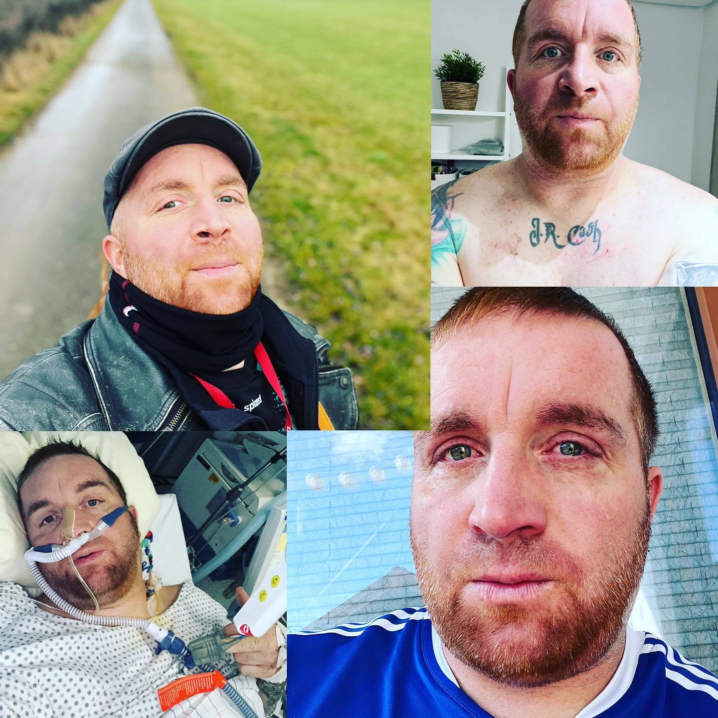 Wer bin ich nur …. Welche Person seht ihr da ? 

Wenn mich selbst und mein Umfeld diese Krankheit was gelernt hat, dass sie dich versucht zu zermürben. Manche kennen nur das eine Wesen … aber es sind viele die in mir schwirren… der traurige, der wütende der am Ende sein Kolbe der Kämpfer aber auch der lustige und fröhliche … der Zuversichtliche…. Der Wegläufer der Mauler und Quängler ….. ich weiß manchmal selber nicht welche das grad ist …. Wie bei dem Film Split …. 

Will man gute Laune flieht man vor sich selber … oder ignoriert den Schmerz… manchmal lache ich über mich selber und über meine Gedanken….. 

Ich muss damit klar kommen … das sind unterschiedliche Bilder … unterschiedliche Situationen … unterschiedliche Tage und Gefühle … 

Der Inhalt bin aber immer ICH …. Ich hab Angst und das ist okay … ich bin traurig … das ist okay … aber das größte Bild von allen ist der NORMALE KOLBE …. der Großteil … der will ich sein …. Der Micha … der Michi … der den man kennt und den man liebt 😀♥️♥️

#krebsisteinarschloch#darmkrebs#krebskämpfer #krebskrank #cancer #cancerfighter #lifestyle #lifeisgood #lifeisbeautiful #lifecoaching #paliativ #darmkrebs#lifeofadventure #love #selfie #healthylifestyle #healthy #gesundheit #gesundleben #krank #krankheit #lebensfreude #lebengenießen #lebensqualität #lebedeinleben #lebensmotto #fickdichkrebs #zitate