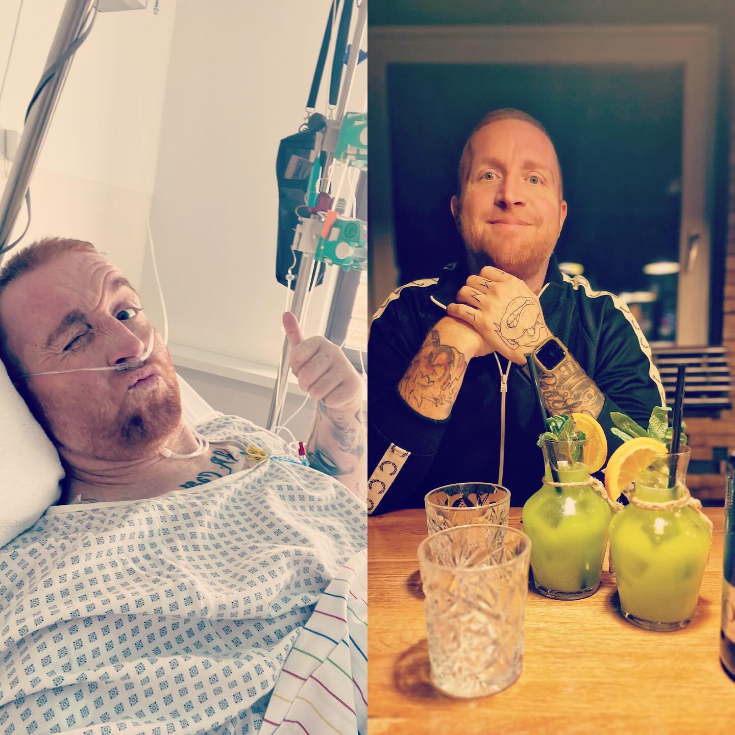 Manchmal liegen dazwischen nur Tage … und man sieht es mir nicht an oftmals.  Dass ich eigentlich richtig böse krank bin. Will es aber auch nicht wahr haben manchmal und versuche irgendwie normal zu sein. Wie früher ? Neeee natürlich nicht. Früher ist weg, es gibt nur noch morgen und übermorgen und 2024 geht’s genauso weiter …. Ich möchte Leben und möchte genau so weitermachen …. Das Leben genießen und die Therapie und den Krebs akzeptieren aber nicht den Raum geben alles zu übernehmen. In meiner Zentrale oben gibt’s kein Platz aktuell dafür, da überwiegt die Freude am Leben. Darum nutze ich die guten Tage und gebe alles, in der Hoffnung morgen nicht wieder flach zu liegen wegen dem nächstes Scheiß den sich der Krebs ausdenkt .

FIGHT 💪🏻💪🏻💪🏻💪🏻💪🏻💪🏻 und niemals den Humor verlieren ‚…… den behalte ich ….

#krebsisteinarschloch #darmkrebs#krebskämpfer #krebskrank #cancer #mutmacher #cancerfighter #lifestyle#cancerblogger #lifeisgood #lifeisbeautiful #lifecoachin #palliativ #darmkrebs#lifeofadventure #dasistpalliativ #selfie #healthylifestyle #healthy #gesundheit #gesundleben #krank #krankheit #lebensfreude #darmkrebskämpfer #krebskrank  #cancerfighter #lebedeinleben #lebensmotto #fickdichkrebs #zitate 
#fckcancer